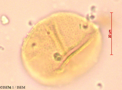 ISEM 1/Canella_winterana_21585/Canella_winterana_21585_0001(copy)_thumb.jpg